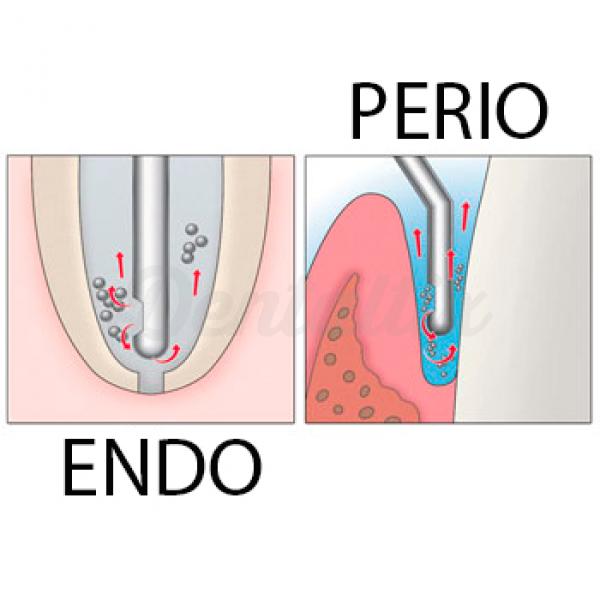 Endo Irrigation Syringes 100/Box (Compare to Max-i-Probe) Perio Irrigation Syringes